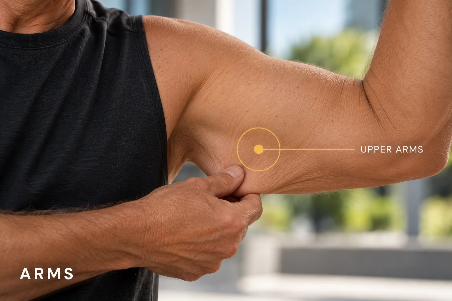 Upper Arms — illustrative treatment-area guide