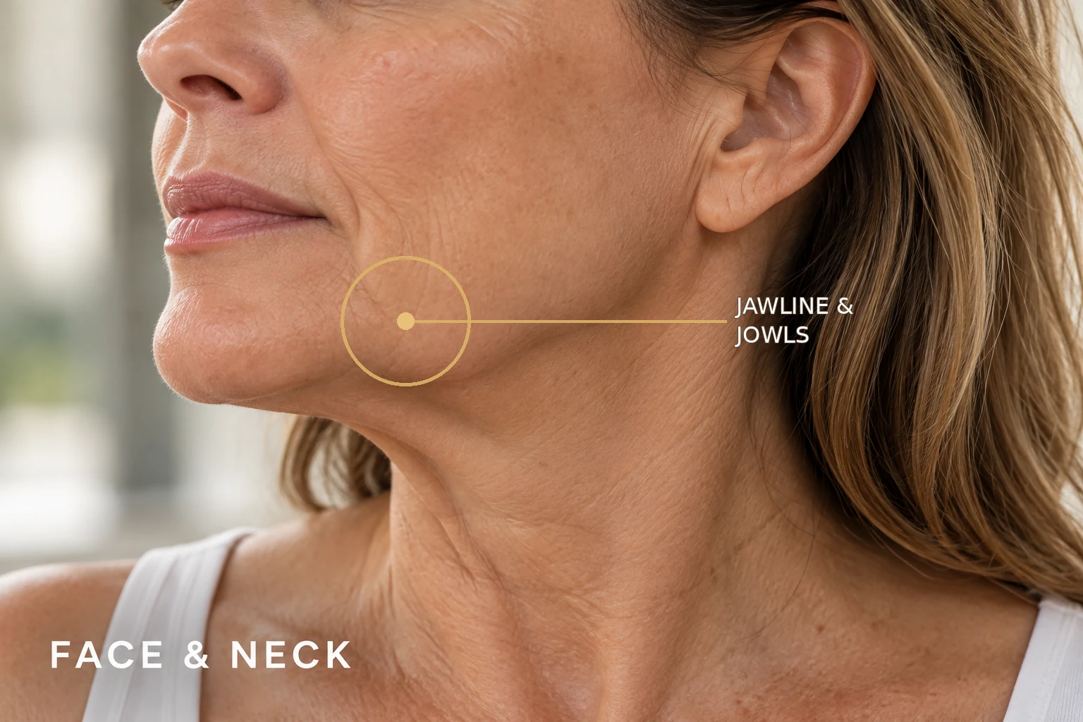 Face & Neck — illustrative treatment-area guide