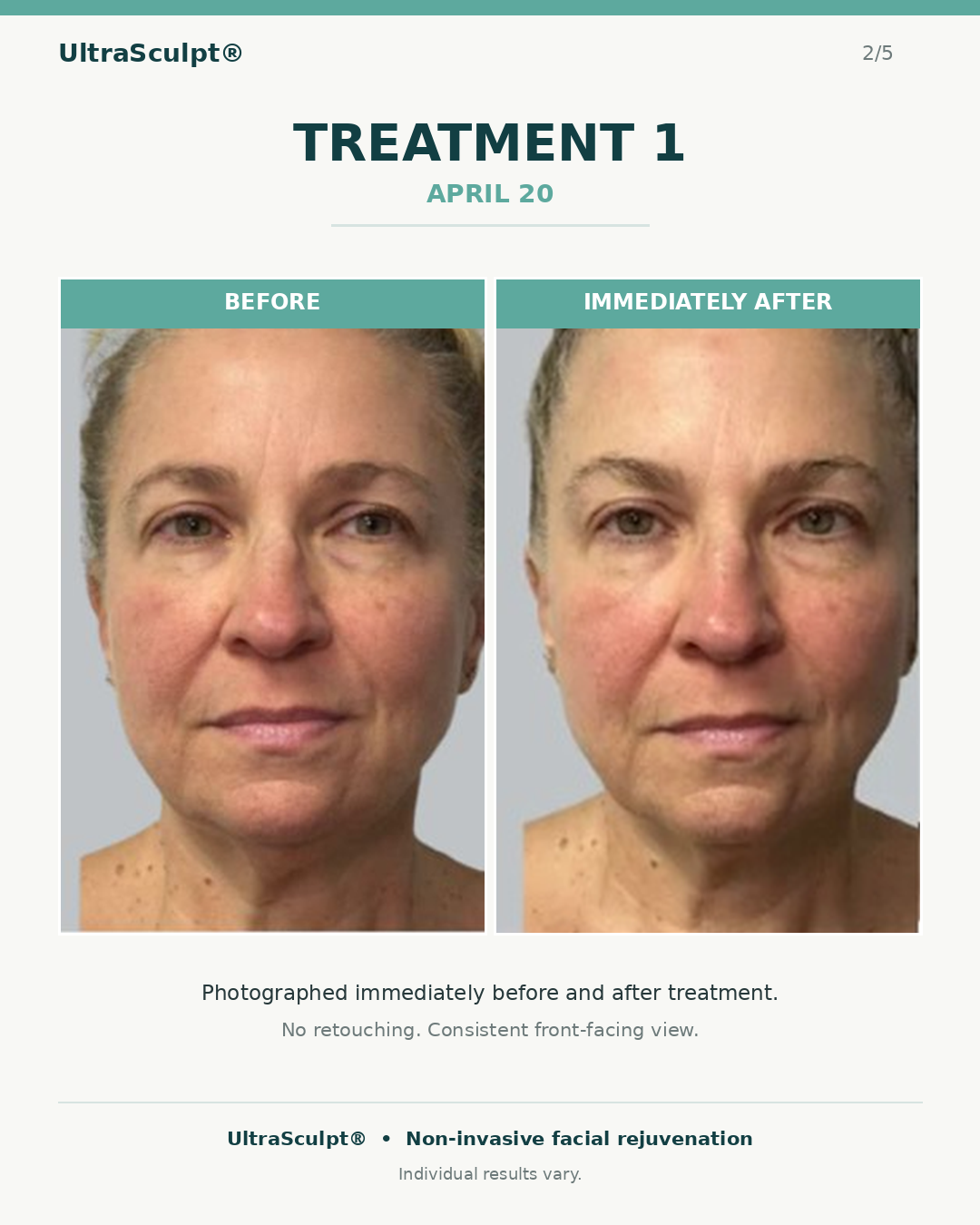 Original labeled Treatment 1 comparison, April 20